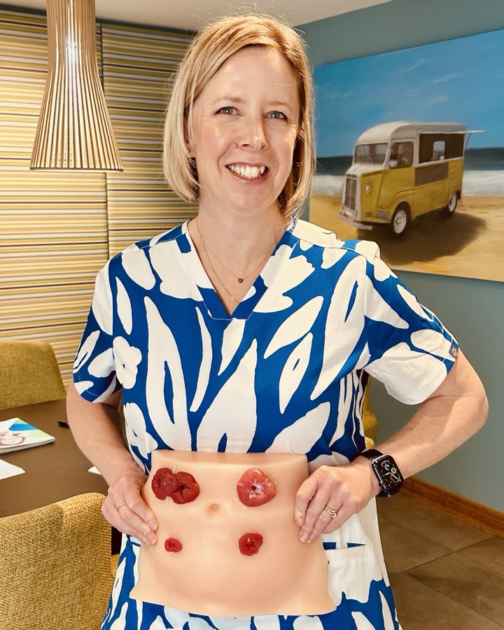 Kelly Taylor, stoma nurse, smiling and holding a training model that shows different types of stoma.